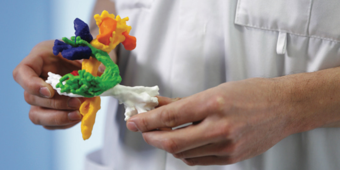 3D print model patient communication