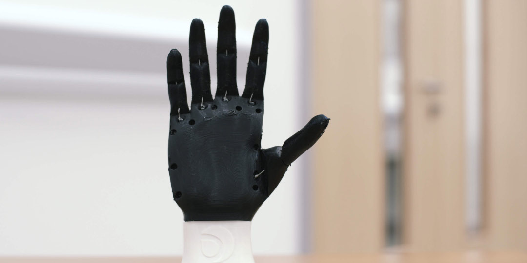 3D printed prosthetic limbs