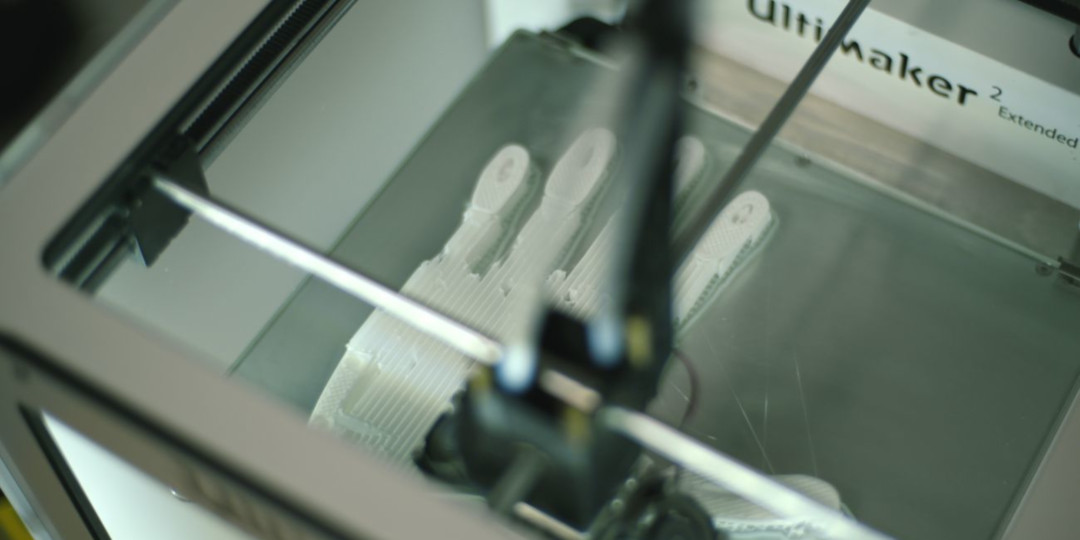 3D printing prosthetic hand