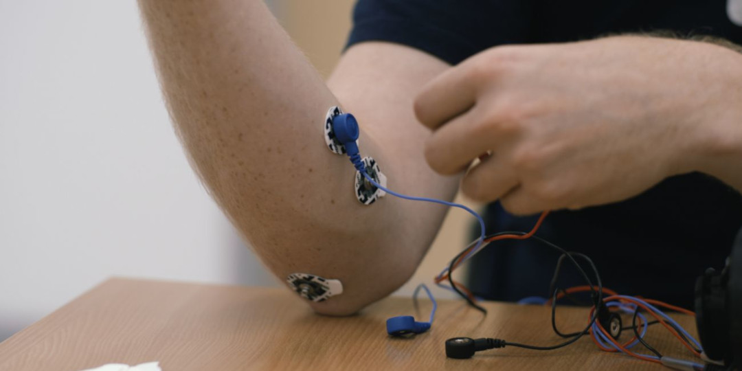Bionic hand sensor placement