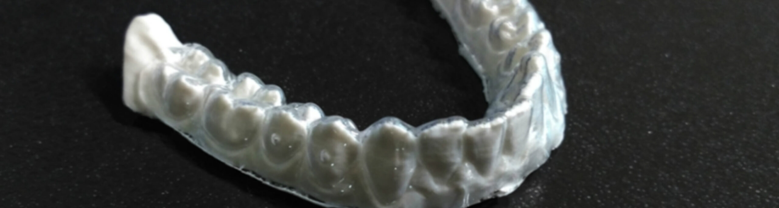 Faster, more accurate dental models 1