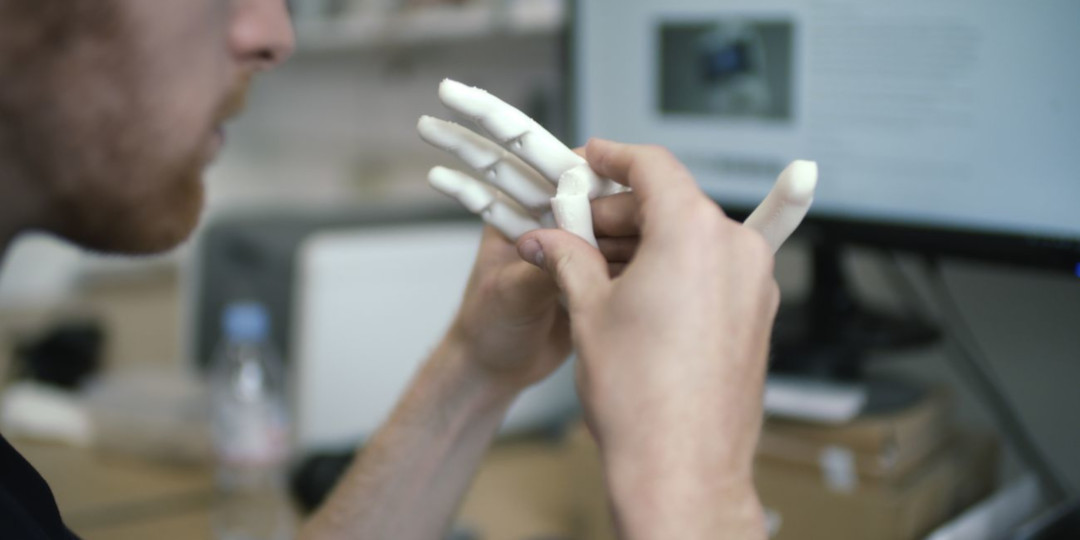 Flexible prosthetic finger joints