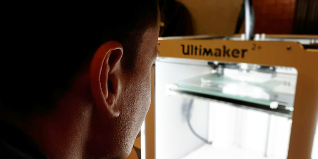 Printing prosthesis on an Ultimaker 2+