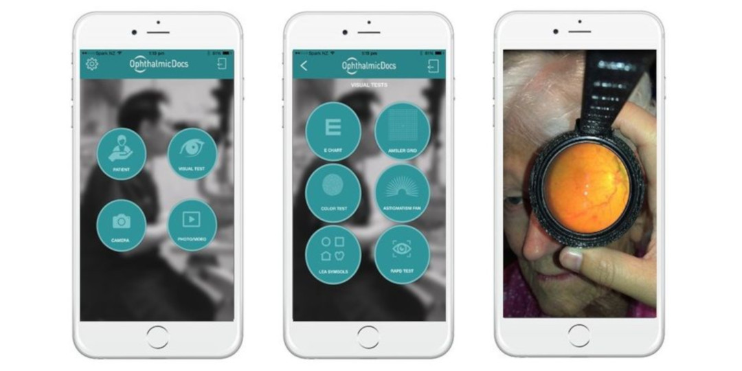 odocs-eye-app-screenshots